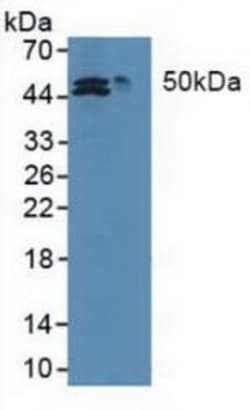 Invitrogen MAT2A Polyclonal Antibody:Antibodies:Primary Antibodies