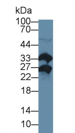Invitrogen MSRA Polyclonal Antibody:Antibodies:Primary Antibodies