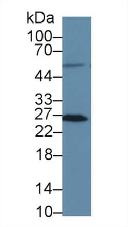 Invitrogen MSRA Polyclonal Antibody 20 &mu;L; Unconjugated:Antibodies,