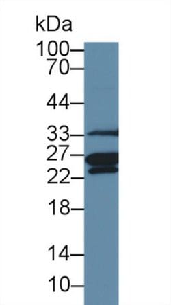 Invitrogen MSRA Polyclonal Antibody:Antibodies:Primary Antibodies