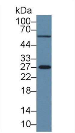 Invitrogen MSRA Polyclonal Antibody:Antibodies:Primary Antibodies