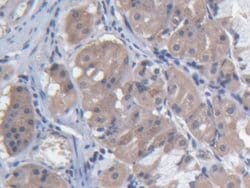 Invitrogen MARS Polyclonal Antibody:Antibodies:Primary Antibodies