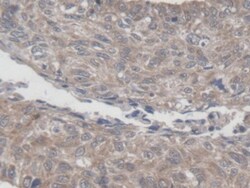 Invitrogen MRPL1 Polyclonal Antibody:Antibodies:Primary Antibodies
