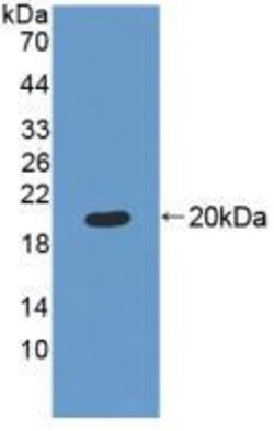Invitrogen MRPL1 Polyclonal Antibody:Antibodies:Primary Antibodies
