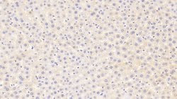 Invitrogen MAP3K6 Polyclonal Antibody:Antibodies:Primary Antibodies