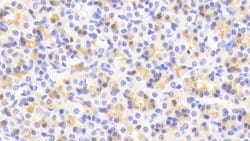 Invitrogen MAP3K6 Polyclonal Antibody:Antibodies:Primary Antibodies