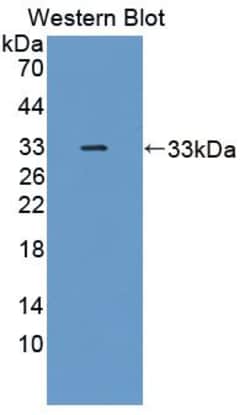 Invitrogen MAP3K6 Polyclonal Antibody:Antibodies:Primary Antibodies