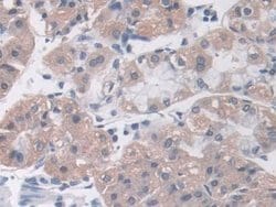 Invitrogen MOSC1 Polyclonal Antibody:Antibodies:Primary Antibodies