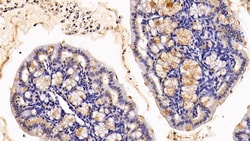 Invitrogen MUC2 Polyclonal Antibody 20 &mu;L; Unconjugated:Antibodies,