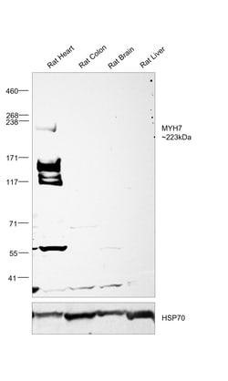 Invitrogen MYH7 Polyclonal Antibody:Antibodies:Primary Antibodies