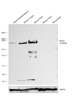 Invitrogen MYH7 Polyclonal Antibody:Antibodies:Primary Antibodies