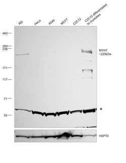 Invitrogen MYH7 Polyclonal Antibody:Antibodies:Primary Antibodies