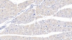 Invitrogen MYH7 Polyclonal Antibody:Antibodies:Primary Antibodies