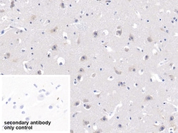 Invitrogen MYH7 Polyclonal Antibody 200 &mu;L | Buy Online | Invitrogen&trade; | Fisher Scientific