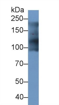 Invitrogen MYH7 Polyclonal Antibody:Antibodies:Primary Antibodies
