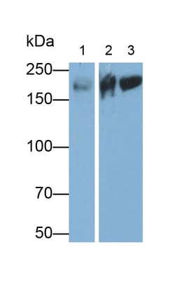 Invitrogen MYH7 Polyclonal Antibody 200 &mu;L | Buy Online | Invitrogen&trade; | Fisher Scientific