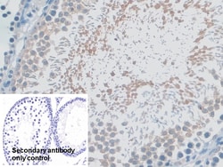 Invitrogen MYO1D Polyclonal Antibody 200 &mu;L; Unconjugated:Antibodies,