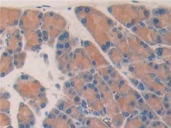 Invitrogen Myostatin Polyclonal Antibody:Antibodies:Primary Antibodies