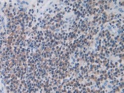 Invitrogen MX1 Polyclonal Antibody 200 &mu;L; Unconjugated:Antibodies,