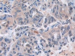 Invitrogen MX1 Polyclonal Antibody 200 &mu;L; Unconjugated:Antibodies,