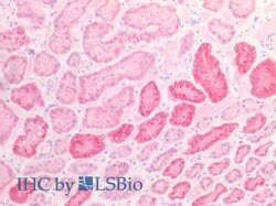 Invitrogen NAGLU Polyclonal Antibody:Antibodies:Primary Antibodies