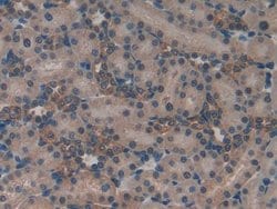 Invitrogen MT-ND5 Polyclonal Antibody:Antibodies:Primary Antibodies
