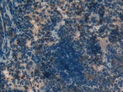 Invitrogen MT-ND5 Polyclonal Antibody:Antibodies:Primary Antibodies