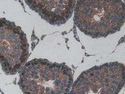 Invitrogen MT-ND5 Polyclonal Antibody:Antibodies:Primary Antibodies
