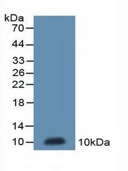 Invitrogen MT-ND5 Polyclonal Antibody:Antibodies:Primary Antibodies