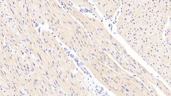 Invitrogen NDUFS1 Polyclonal Antibody 20 &mu;L; Unconjugated:Antibodies,