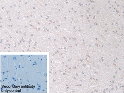 Invitrogen NDUFS1 Polyclonal Antibody 20 &mu;L; Unconjugated:Antibodies,