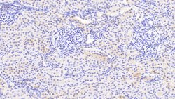 Invitrogen NDUFS1 Polyclonal Antibody 20 &mu;L; Unconjugated:Antibodies,
