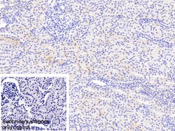 Invitrogen NDUFS1 Polyclonal Antibody 20 &mu;L; Unconjugated:Antibodies,