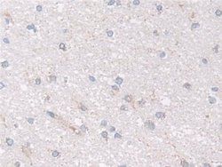 Invitrogen NDUFS1 Polyclonal Antibody 20 &mu;L; Unconjugated:Antibodies,