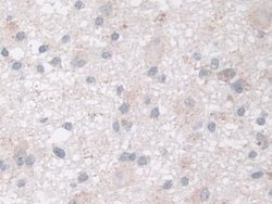 Invitrogen NDUFS1 Polyclonal Antibody 20 &mu;L; Unconjugated:Antibodies,