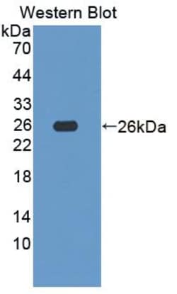 Invitrogen NDUFS1 Polyclonal Antibody 20 &mu;L; Unconjugated:Antibodies,
