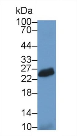 Invitrogen CD336 (NKp44) Polyclonal Antibody 200 &mu;L; Unconjugated:Antibodies,