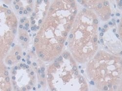 Invitrogen INVS Polyclonal Antibody:Antibodies:Primary Antibodies
