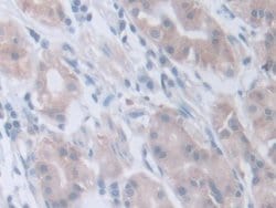 Invitrogen INVS Polyclonal Antibody:Antibodies:Primary Antibodies