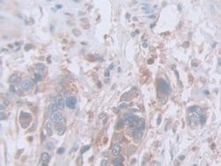 Invitrogen INVS Polyclonal Antibody:Antibodies:Primary Antibodies