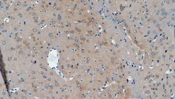Invitrogen NCDN Polyclonal Antibody:Antibodies:Primary Antibodies