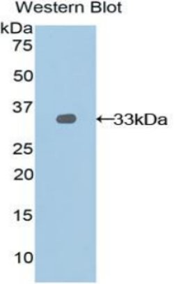 Invitrogen Nexilin Polyclonal Antibody 200 &mu;L; Unconjugated:Antibodies,