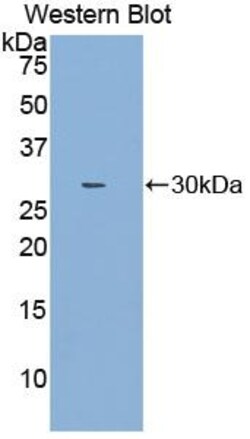 Invitrogen NOSIP Polyclonal Antibody 200 &mu;L; Unconjugated:Antibodies,
