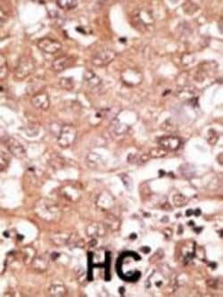 Invitrogen BMP9 Polyclonal Antibody 400 &mu;L; Unconjugated:Antikroppar