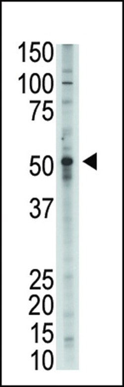 Invitrogen BMP9 Polyclonal Antibody 400 &mu;L; Unconjugated:Antikroppar