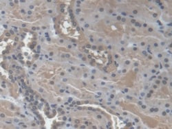 Invitrogen NME3 Polyclonal Antibody 20 &mu;L; Unconjugated:Antibodies,