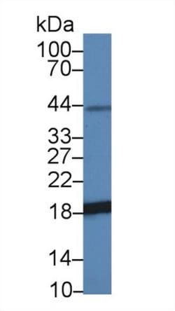 Invitrogen NME3 Polyclonal Antibody 20 &mu;L; Unconjugated:Antibodies,