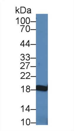 Invitrogen NME3 Polyclonal Antibody 20 &mu;L; Unconjugated:Antibodies,