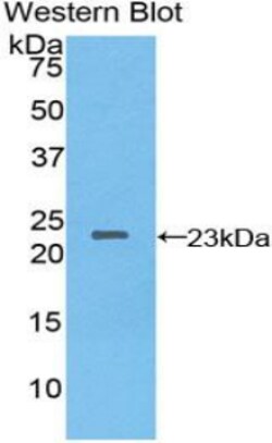 Invitrogen NME3 Polyclonal Antibody 20 &mu;L; Unconjugated:Antibodies,