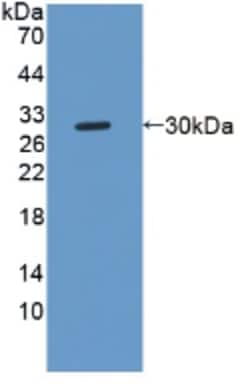 Invitrogen NOTCH2NL Polyclonal Antibody 200 &mu;L; Unconjugated:Antibodies,
